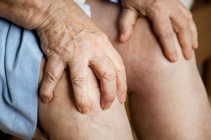 elderly woman suffering knee pain PGLZRTG
