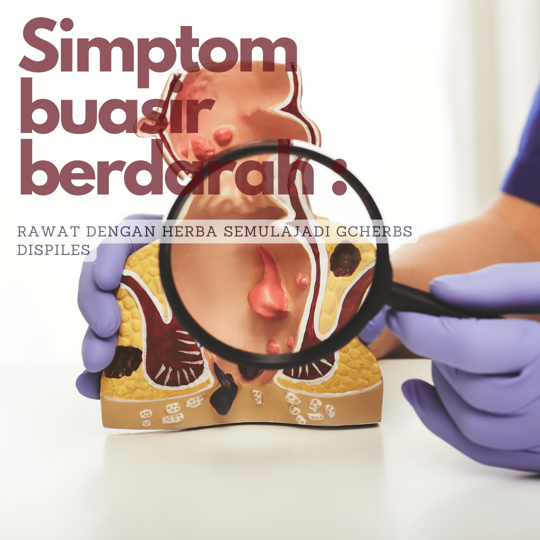 buasir berdarah dan rawatan